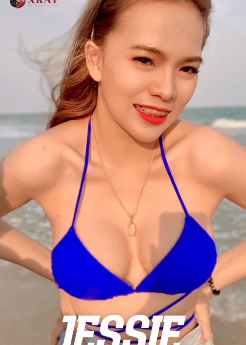 변마물집 엑스레이