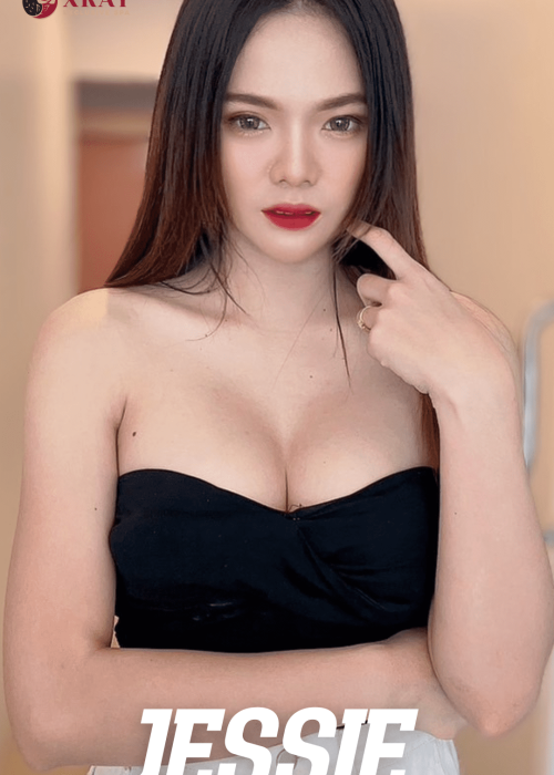 변마물집 엑스레이